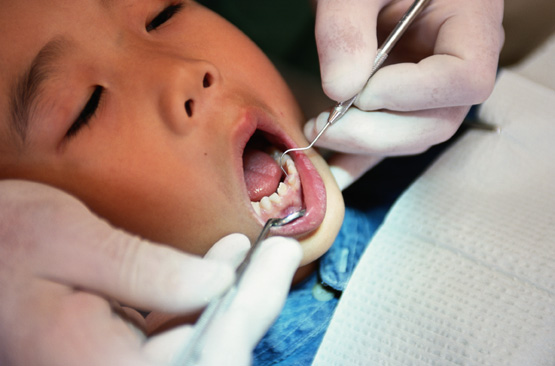 Dentist working inside a young patient's mouth