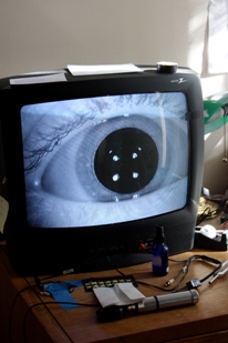 Closeup of eye during videonystagmography